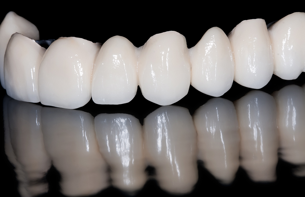 Dental bridges in Daly City, CA